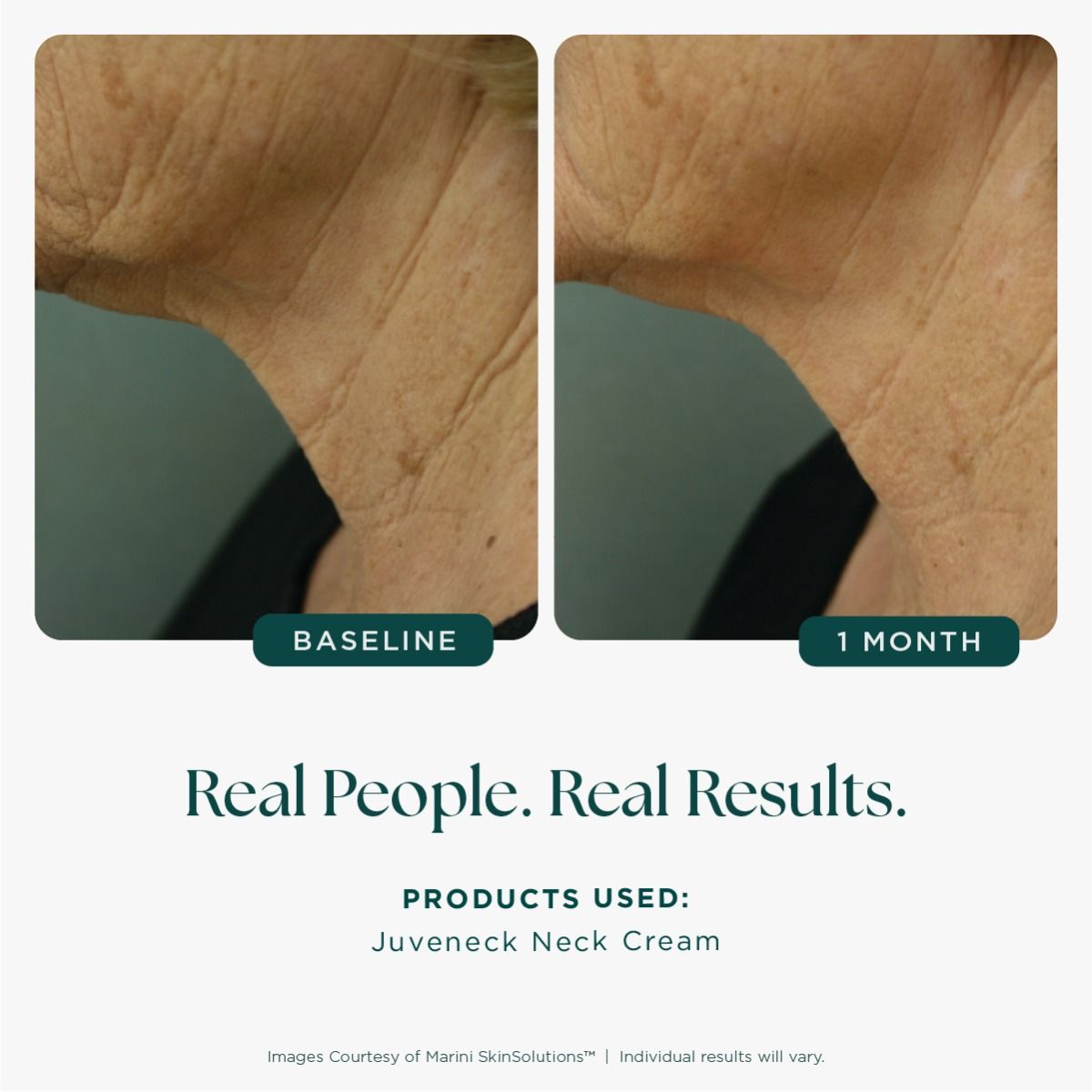 juveneck_neck_cream_front_