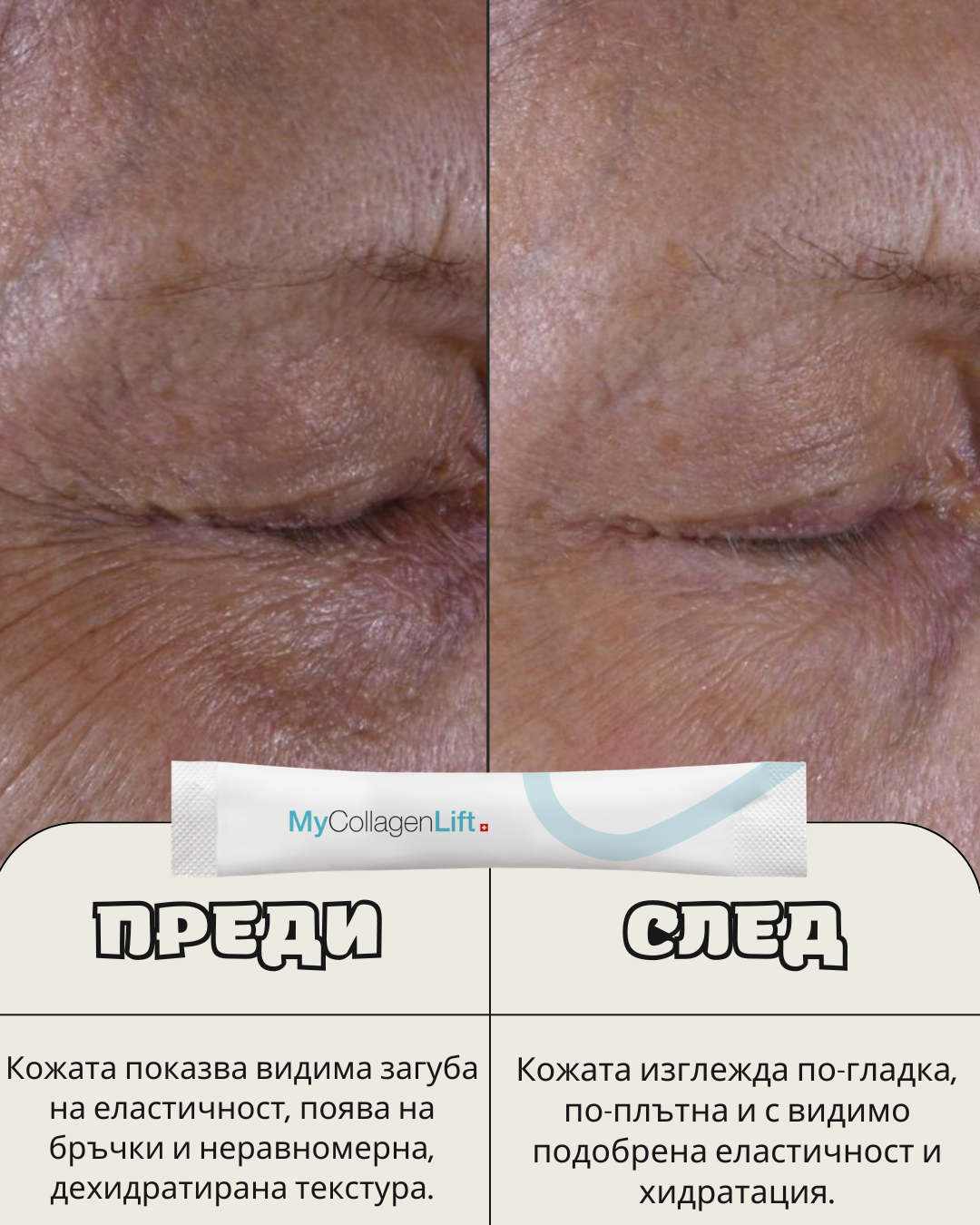 MyCollagenLift